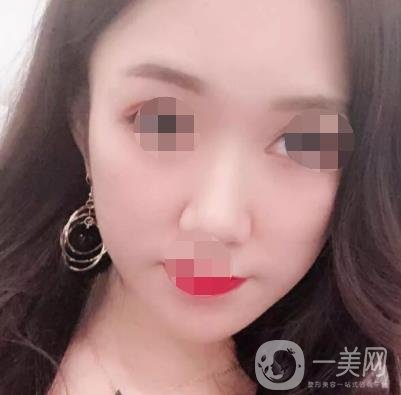 徐州第一人民醫(yī)院整形科價格表，含激光祛疤*果