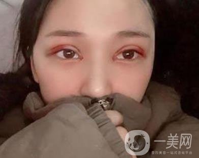 恩施州中心醫(yī)院美容整形科怎么樣？價格表和雙眼皮整形經(jīng)歷分享