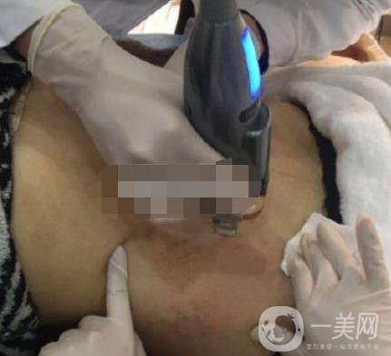 汾陽醫(yī)院美容整形科祛妊娠紋怎么樣？手術(shù)項(xiàng)目收費(fèi)價格表和案例一覽