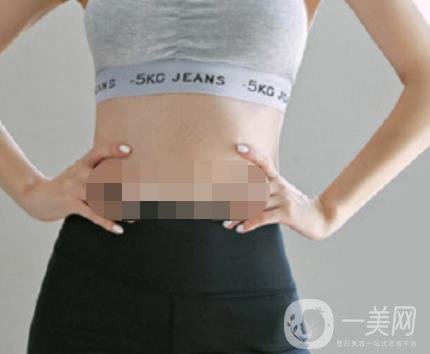 汾陽醫(yī)院美容整形科祛妊娠紋怎么樣？手術(shù)項(xiàng)目收費(fèi)價格表和案例一覽