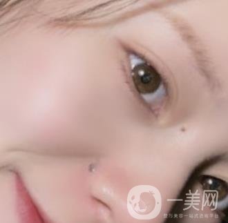 黃岡市中心醫(yī)院美容整形科祛痣多少錢？價格費用表和*果圖精選