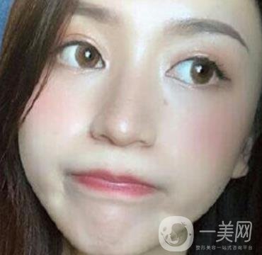 荊州市第三人民醫(yī)院整形美容科*祛斑*果好嗎？收費價格明細表一覽