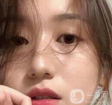 荊州市第三人民醫(yī)院整形美容科*祛斑*果好嗎？收費價格明細表一覽