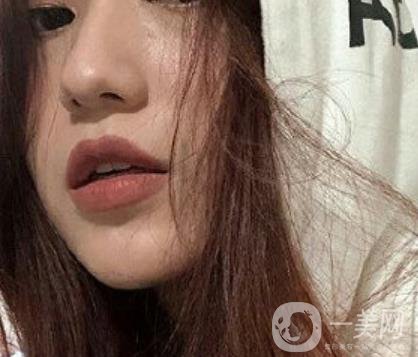 荊州市第三人民醫(yī)院整形美容科*祛斑*果好嗎？收費價格明細表一覽