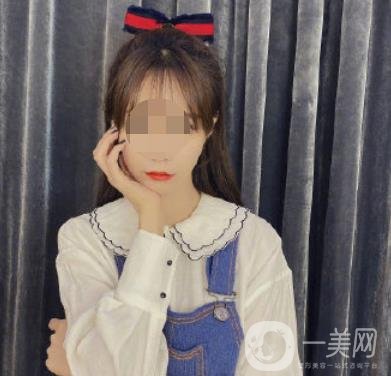 河北省人民醫(yī)院激光祛斑多少錢?附2020整形價(jià)格表一覽