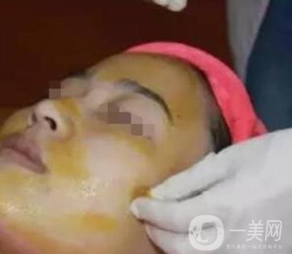 湖南省人民醫(yī)院點(diǎn)陣激光祛斑價(jià)格表及案例分享