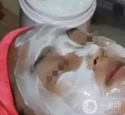 湖南省人民醫(yī)院點(diǎn)陣激光祛斑價(jià)格表及案例分享