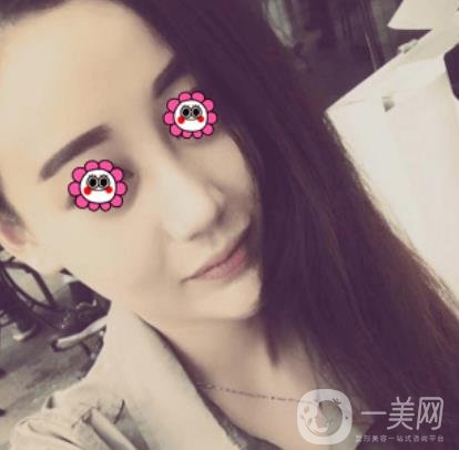 鼓樓醫(yī)院可以打*嗎?附案例恢復(fù)圖及整形價格表