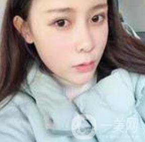 蘇州附一醫(yī)院可以激光祛斑嗎?案例圖及整形價格表分享