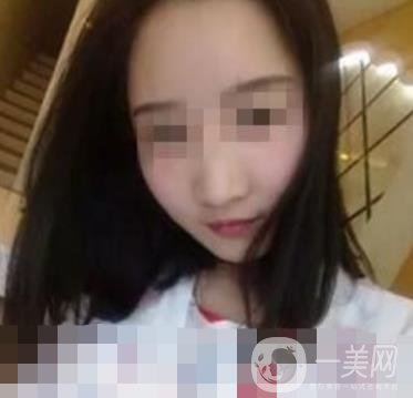 河南省人民醫(yī)院脂肪填充