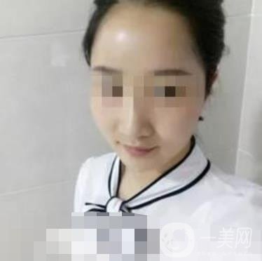 河南省人民醫(yī)院脂肪填充