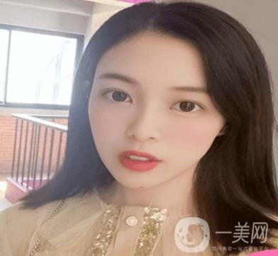 贛州附屬醫(yī)院整形美容科價格表及點痣案例公布，速覽