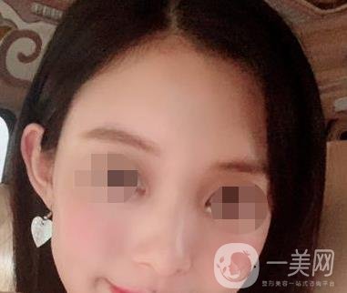 贛州附屬醫(yī)院整形美容科價格表及點痣案例公布，速覽