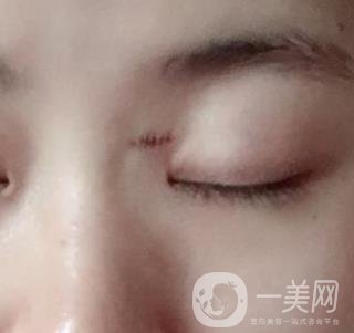 贛州附屬醫(yī)院整形美容科價格表及點痣案例公布，速覽