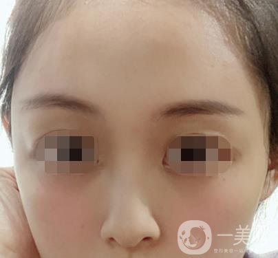 贛州附屬醫(yī)院整形美容科價格表及點痣案例公布，速覽