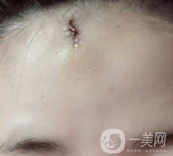 南昌二附院整形美容科價(jià)格表及祛痣日志公開，速覽