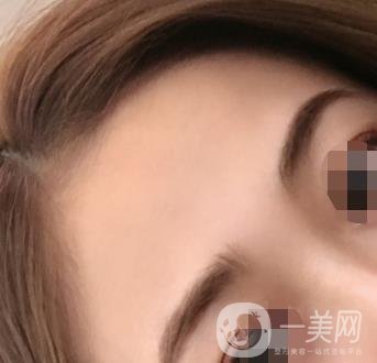 南昌二附院整形美容科價(jià)格表及祛痣日志公開，速覽