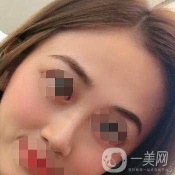 南昌二附院整形美容科價(jià)格表及祛痣日志公開，速覽