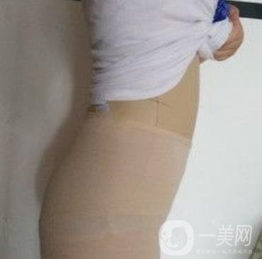 襄陽市第一人民醫(yī)院整形美容科吸脂瘦肚子多少錢？價格表整形日記一覽