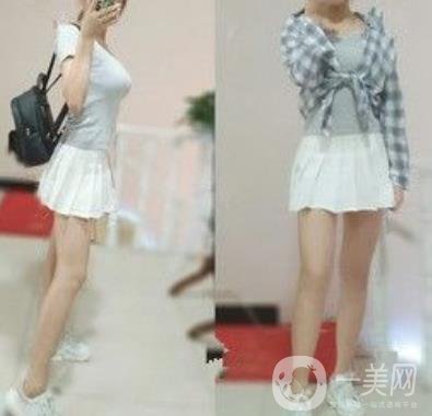 襄陽市第一人民醫(yī)院整形美容科吸脂瘦肚子多少錢？價格表整形日記一覽