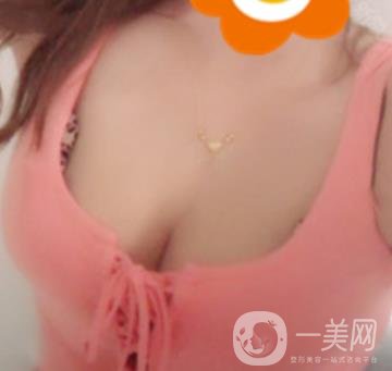 廣州南方醫(yī)院美容科怎么樣?附2020全新價(jià)格表及隆胸案例