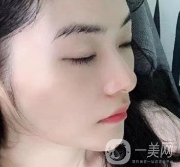 廣州南方醫(yī)院去眼袋費用多少?2020整形價格表一覽