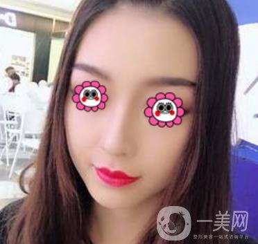 沈陽杏林崔昌墉做鼻子怎么樣?2020整形價(jià)格表一覽