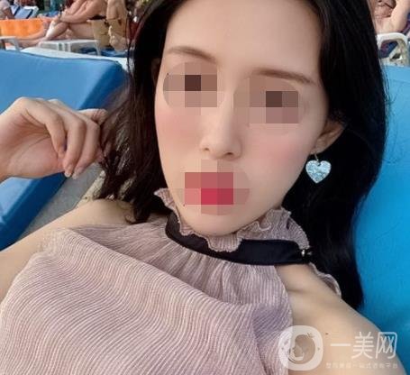 南大一附院整形美容科價格表2020版及祛疤案例