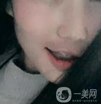 桂林美奧口腔醫(yī)院價格表全新版，附牙齒矯正案例