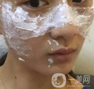 青醫(yī)附院整形美容科價格表及祛斑案例公布，速覽