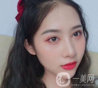 南通市第三人民醫(yī)院整形科價(jià)格表+隆鼻整形案例一覽