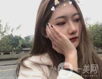 重慶新橋醫(yī)院整形科價格表，隆鼻案例分享