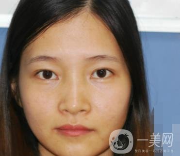 北京朝陽(yáng)醫(yī)院整形中心紋眉*果怎么樣？?jī)r(jià)格價(jià)目表詳情一覽