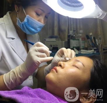 北京朝陽(yáng)醫(yī)院整形中心紋眉*果怎么樣？?jī)r(jià)格價(jià)目表詳情一覽