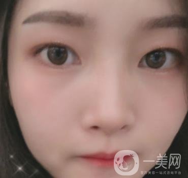 北京朝陽(yáng)醫(yī)院整形中心紋眉*果怎么樣？?jī)r(jià)格價(jià)目表詳情一覽