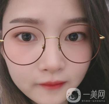 北京朝陽(yáng)醫(yī)院整形中心紋眉*果怎么樣？?jī)r(jià)格價(jià)目表詳情一覽