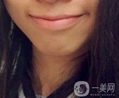 復旦大學附屬兒科醫(yī)院口腔科做牙齒矯正多少錢？價格表明細一覽