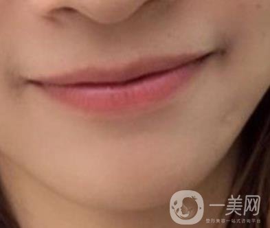 復旦大學附屬兒科醫(yī)院口腔科做牙齒矯正多少錢？價格表明細一覽