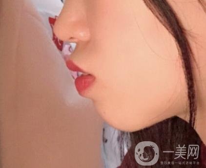 復旦大學附屬兒科醫(yī)院口腔科做牙齒矯正多少錢？價格表明細一覽