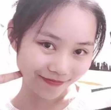 淮安第一人民醫(yī)院割雙眼皮怎樣?真人案例及整形價(jià)格表分享