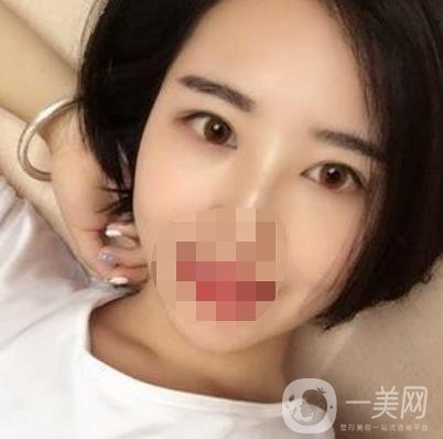 長海醫(yī)院去眼袋