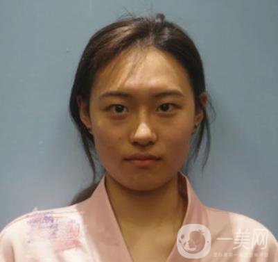 西京醫(yī)院整眼袋