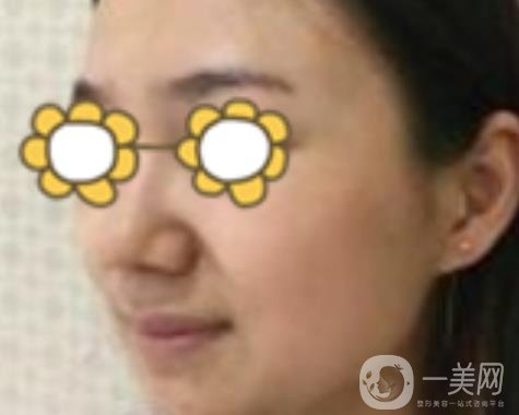 阜陽(yáng)市人民醫(yī)院整形美容科價(jià)格表2020版，附*案例