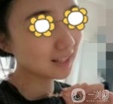 阜陽(yáng)市人民醫(yī)院整形美容科價(jià)格表2020版，附*案例