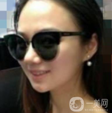 阜陽(yáng)市人民醫(yī)院整形美容科價(jià)格表2020版，附*案例