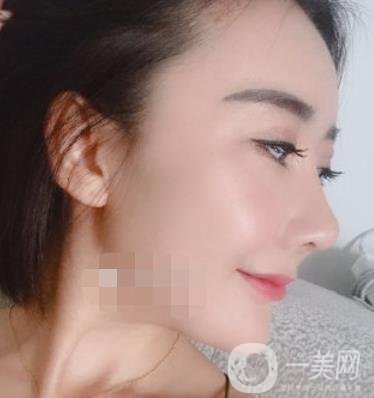 哈爾濱醫(yī)大二院整形美容科價(jià)格表上線，附*案例