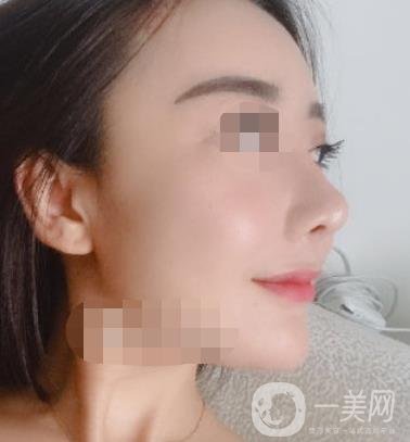 哈爾濱醫(yī)大二院整形美容科價(jià)格表上線，附*案例