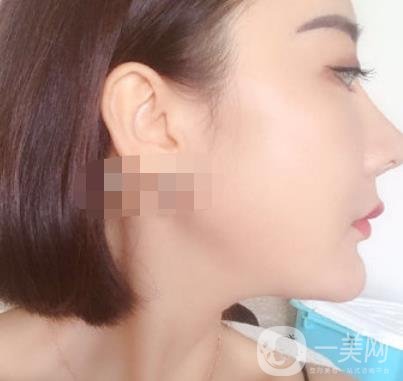 哈爾濱醫(yī)大二院整形美容科價(jià)格表上線，附*案例