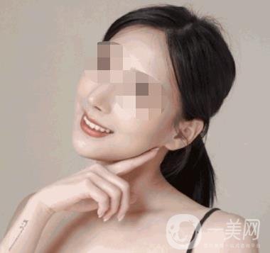 河南省人民醫(yī)院整形美容科價(jià)格表公布，附除腋臭案例