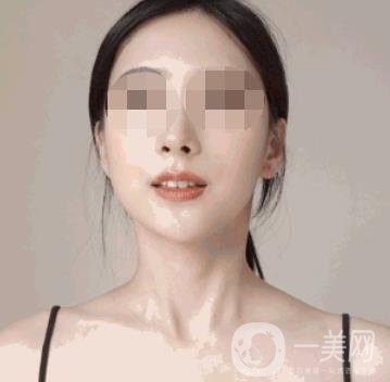 河南省人民醫(yī)院整形美容科價(jià)格表公布，附除腋臭案例